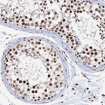 Anti-QRICH1 antibody produced in rabbit，100UL，HPA037677-100UL，Sigma