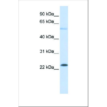 抗-KRAS，100UL，SAB2108685-100UL，Sigma