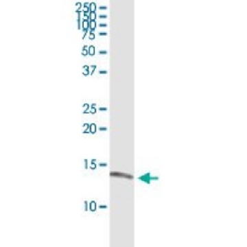 Monoclonal Anti-ISCA1 antibody produced in mouse，100UG，SAB1401866-100UG，Sigma