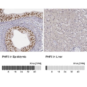 抗-PHF6 兔抗，100UL，HPA001023-100UL，Sigma