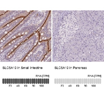Anti-SLC6A19 antibody produced in rabbit，100UL，HPA043207-100UL，Sigma