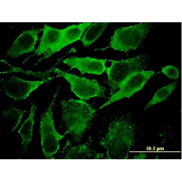 Monoclonal Anti-YKT6, (C-terminal) antibody produced in mouse，100UG，SAB1403078-100UG，Sigma