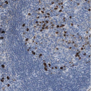 Anti-IFNAR1 antibody produced in rabbit，100UL，HPA018015-100UL，Sigma