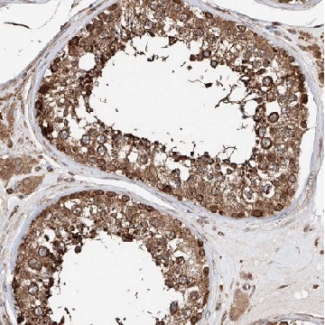 Anti-DNAH8 antibody produced in rabbit，100UL，HPA028447-100UL，Sigma