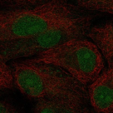 Anti-Tcf21 Antibody Produced In Rabbit，1004G，HPA025769-100UL，Sigma