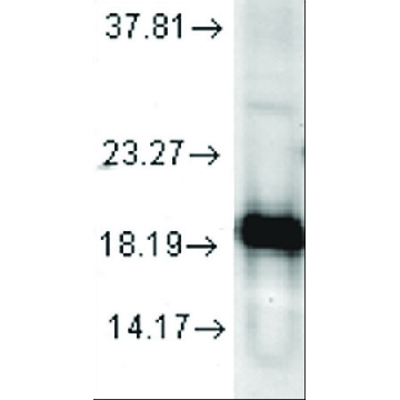 Anti-SOD1 antibody produced in rabbit，100UG，SAB5200083-100UG，Sigma