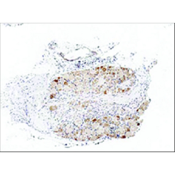 抗-TRPA1 兔抗，100UL，SAB2105082-100UL，Sigma