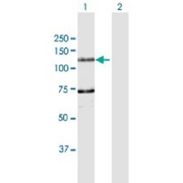 Anti-DDHD1 antibody produced in rabbit，100UG，SAB1411462-100UG，Sigma