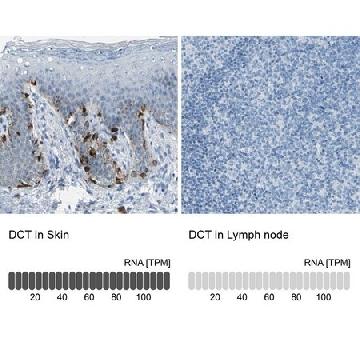 Anti-DCT antibody produced in rabbit，100UL，HPA010743-100UL，Sigma