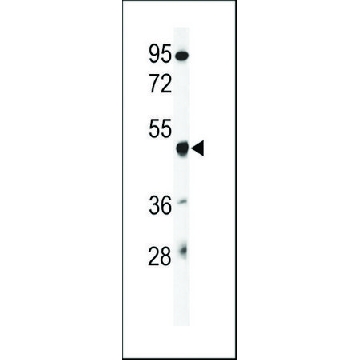 ANTI-GSDMA(N-TERMINAL) antibody produced in rabbit，400UL，SAB1307178-400UL，Sigma