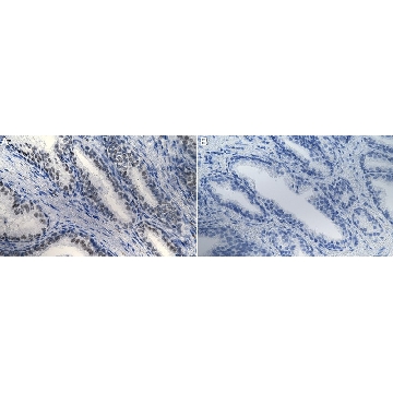 Anti-BRG1/SMARCA4 Antibody, clone 20C3.2 ZooMAb® Mouse Monoclonal，4X25UL，ZMS1177-4X25UL，Sigma