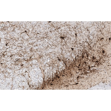 Anti-Tyrosine Hydroxylase Antibody, clone 2/40/15 ZooMAb® Mouse Monoclonal，4X25UL，ZMS1033-4X25UL，Sigma