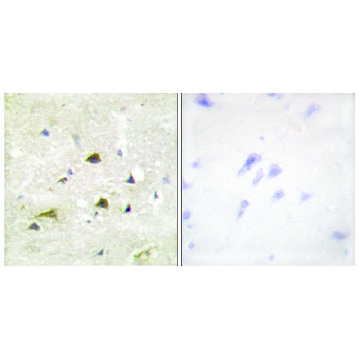 Anti-IKK-β antibody produced in rabbit，100UG，SAB4501535-100UG，Sigma