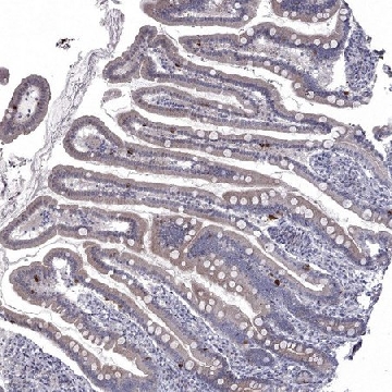 Anti-NRARP antibody produced in rabbit，100UL，HPA025729-100UL，Sigma