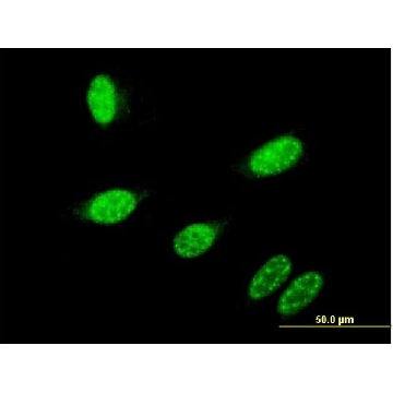 Monoclonal Anti-GBX2 antibody produced in mouse，100UG，WH0002637M1-100UG，Sigma