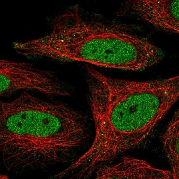 Anti-SFMBT1 antibody produced in rabbit，100UL，HPA064564-100UL，Sigma