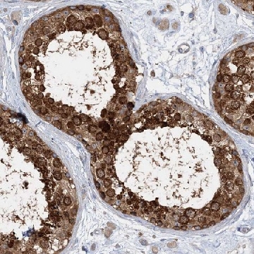 Anti-FAM114A2 antibody produced in rabbit，100UL，HPA035870-100UL，Sigma