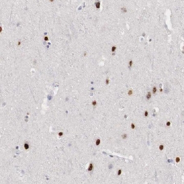 Anti-FOXP2 antibody produced in rabbit，100UL，HPA000382-100UL，Sigma