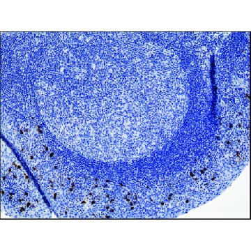 Anti-Human IgA2 antibody, Rabbit monoclonal，100UG，SAB5600218-100UG，Sigma