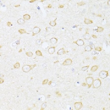 Anti-SQSTM1/p62 antibody produced in rabbit，100UL，SAB5700845-100UL，Sigma
