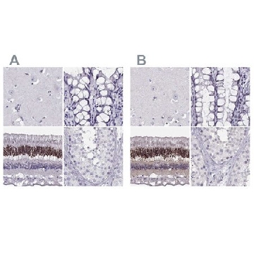 Anti-CRX antibody produced in rabbit，100UL，HPA036762-100UL，Sigma