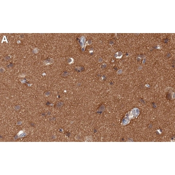 Anti-Tau Antibody, clone Tau 12 ZooMAb® Mouse Monoclonal，4X25UL，ZMS1065-4X25UL，Sigma