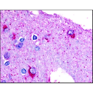 Anti-PYGB (AB2) antibody produced in rabbit，50UG，SAB2900066-50UG，Sigma