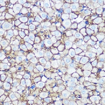 Anti-Annexin A2 antibody produced in rabbit，100UL，SAB5700941-100UL，Sigma