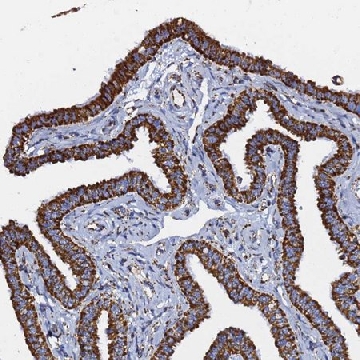 Anti-PHB2 antibody produced in rabbit，100UL，HPA039874-100UL，Sigma