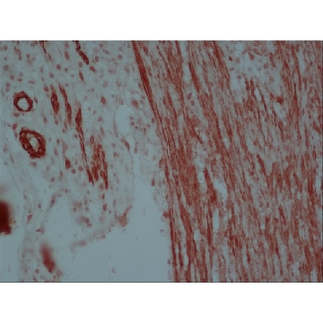 抗-小鼠IgG（Fc特异性）-过氧化物酶 山羊抗，1ML，A2554-1ML，Sigma