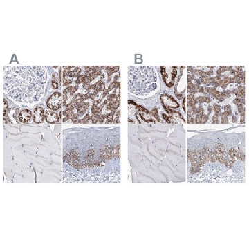 Anti-MCCC2 antibody produced in rabbit，100UL，HPA038300-100UL，Sigma