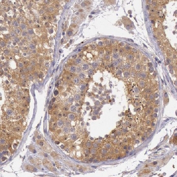 Anti-CDK16 antibody produced in rabbit，100UL，HPA001366-100UL，Sigma