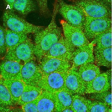 Anti-STAT1 (alpha & beta) clone 3G14 ZooMAb® Rabbit Monoclonal，4X25UL，ZRB1497-4X25UL，Sigma