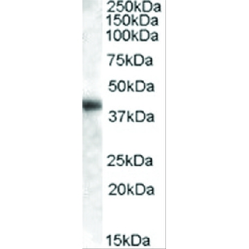 Anti-GOT1 (AA 157-167) antibody produced in goat，100UG，SAB2500473-100UG，Sigma