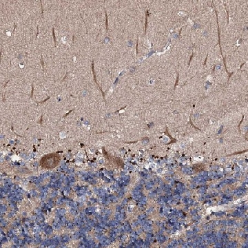 Anti-CKAP5 antibody produced in rabbit，100UL，HPA040375-100UL，Sigma