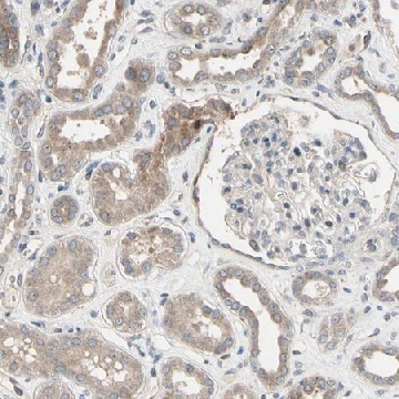 Anti-SNX29 antibody produced in rabbit，100UL，HPA008889-100UL，Sigma