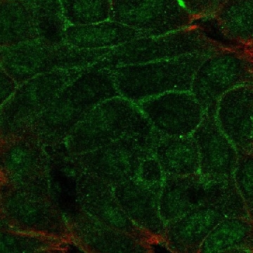 Anti-Tmem52 Antibody Produced In Rabbit，1004G，HPA079372-100UL，Sigma
