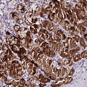 Anti-MB21D2 antibody produced in rabbit，100UL，HPA044026-100UL，Sigma