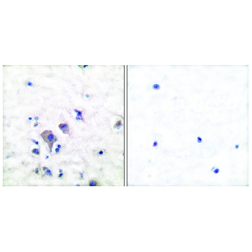 Anti-MGLUR2 antibody produced in rabbit，100UG，SAB4501318-100UG，Sigma