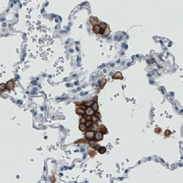 Monoclonal Anti-MRC1 antibody produced in mouse，100UL，AMAB90746-100UL，Sigma