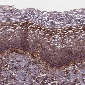 Anti-AEBP1 antibody produced in rabbit，100UL，HPA064970-100UL，Sigma