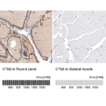 Anti-CTSB antibody produced in rabbit，100UL，HPA018156-100UL，Sigma