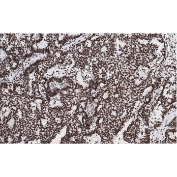 Anti-p-ATM (Ser1981) Antibody, clone 1E19, ZooMAb® Rabbit Monoclonal，4X25UL，ZRB1370-4X25UL，Sigma