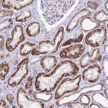 Anti-CBWD1 antibody produced in rabbit，100UL，HPA042813-100UL，Sigma