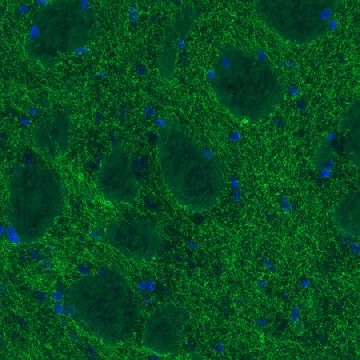 Monoclonal Anti-DAT antibody produced in mouse，100UL，AMAB91125-100UL，Sigma