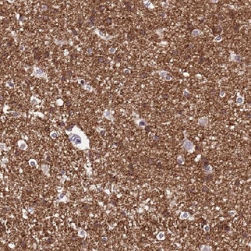 Anti-NLRP11 antibody produced in rabbit，100UL，HPA046402-100UL，Sigma
