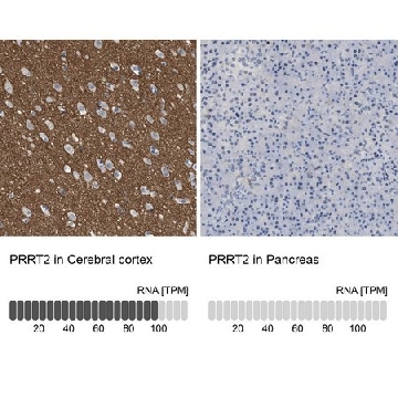 Anti-PRRT2 antibody produced in rabbit，100UL，HPA014447-100UL，Sigma