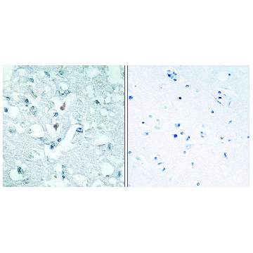 Anti-GLCTK antibody produced in rabbit，100UG，SAB4500407-100UG，Sigma