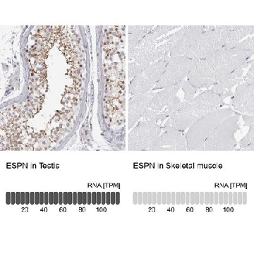 Anti-ESPN antibody produced in rabbit，100UL，HPA028674-100UL，Sigma