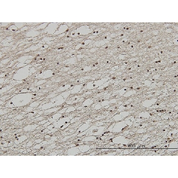 Monoclonal Anti-FOXC2 antibody produced in mouse，100UG，WH0002303M2-100UG，Sigma